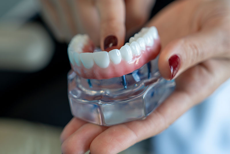 close up of dental implant model