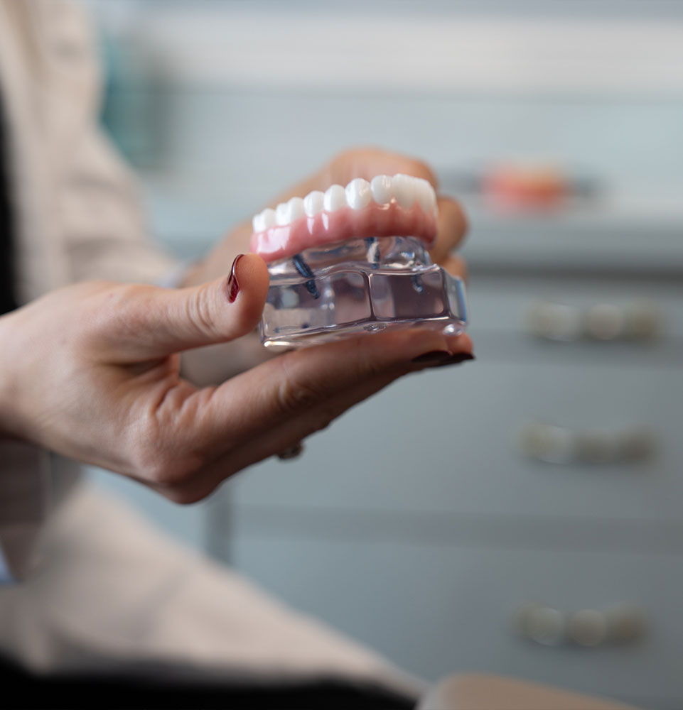 close up of dental implant model
